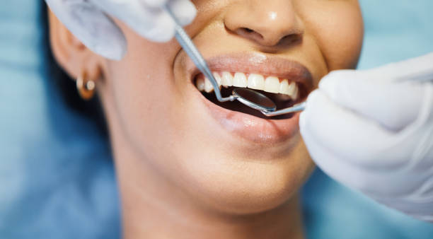 Best Emergency Denture Repair in Buchanan, NY